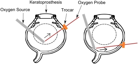 eye with oxygen probe.jpg